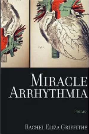 Miracle Arrhythmia